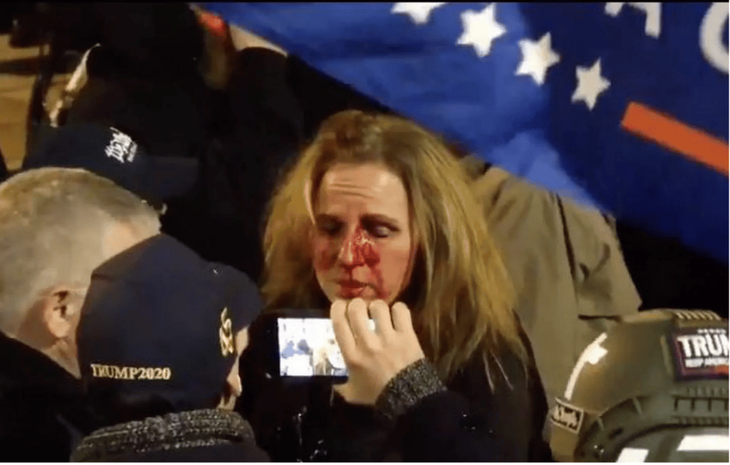 Therese Duke is treated after being punched for harassing a security guard