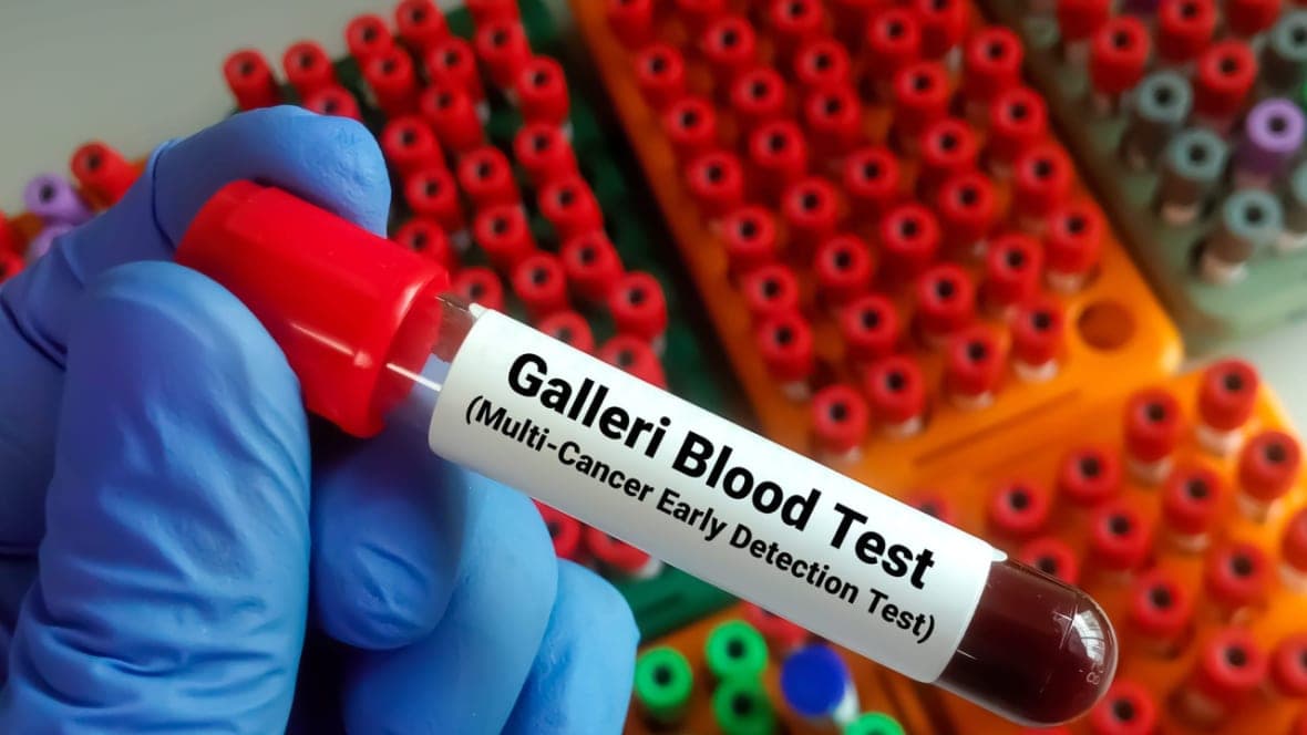 Galleri test