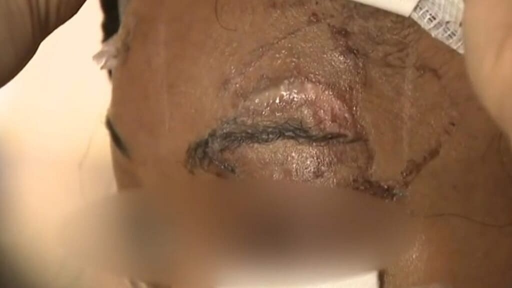 A woman in New York City claims a man tried to bite her eye out