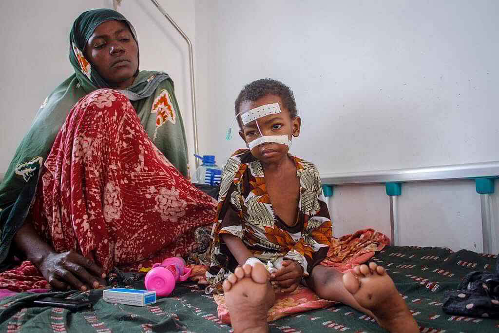 Kalson Hussein, a malnourished child with medical tape across her forehead and nose, sits by her mother Isho Shukria