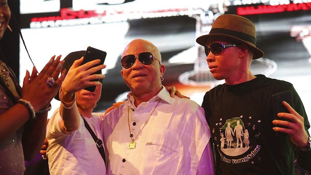 Albino thegrio.com AP