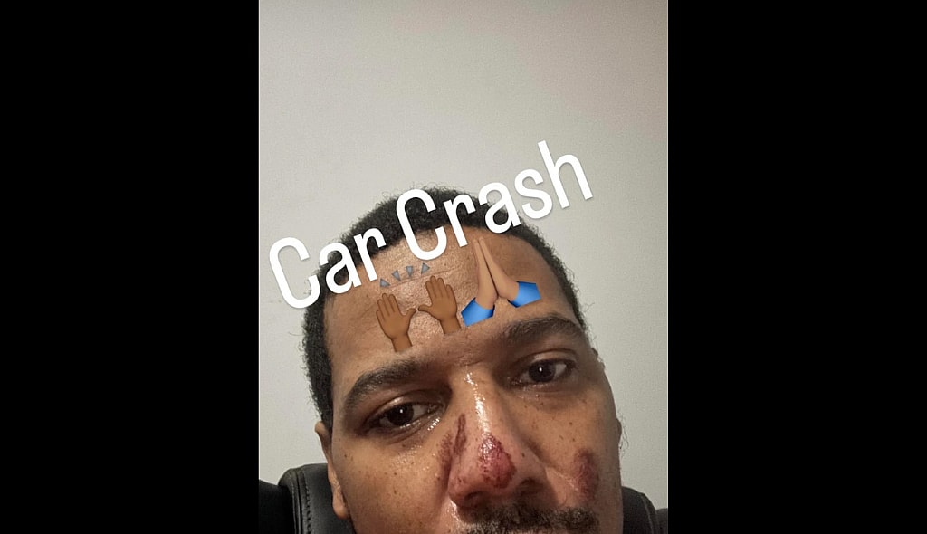 Juelz Santana Instagram story revealing injured face