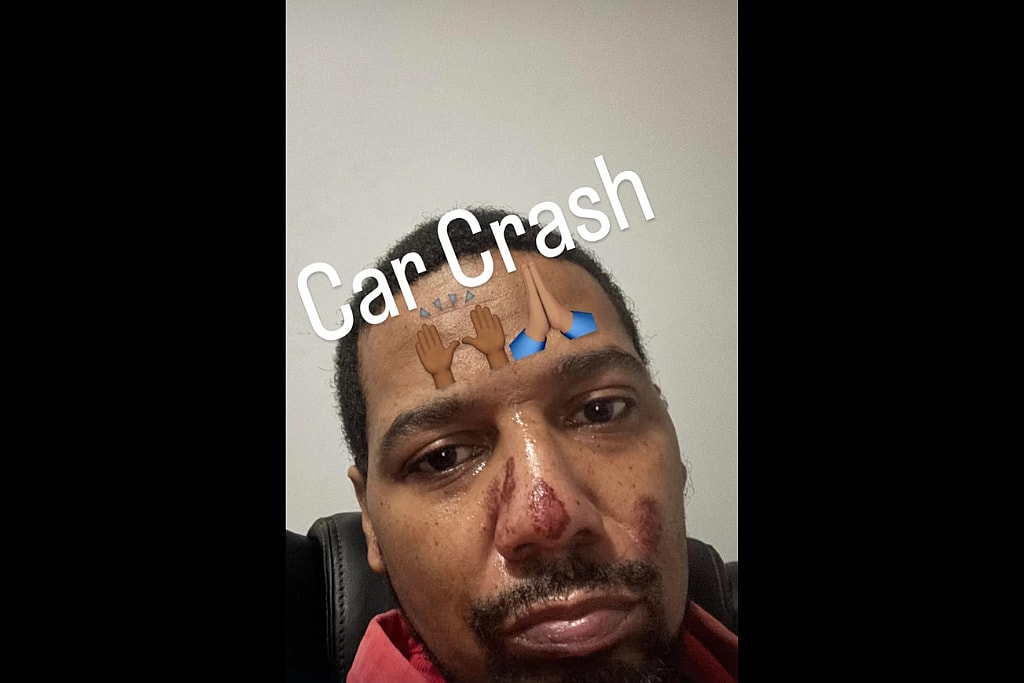 Juelz Santana Instagram story revealing injured face