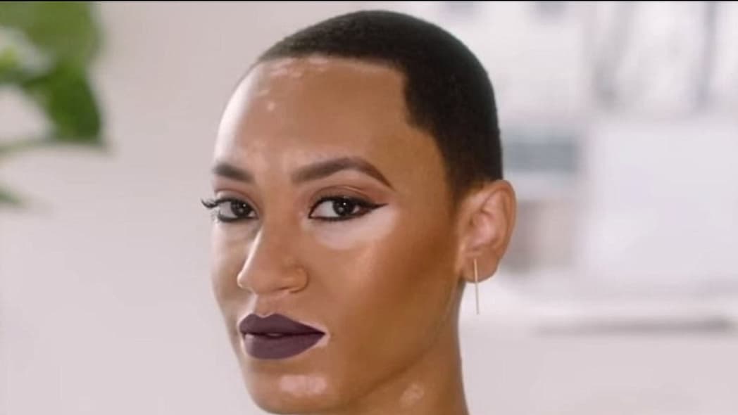 Amy Deanna becomes CoverGirl's first model with vitiligo. (CoverGirl) thegrio.com