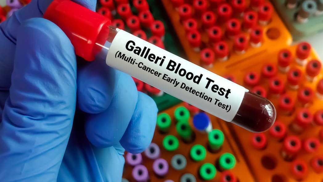 Galleri test