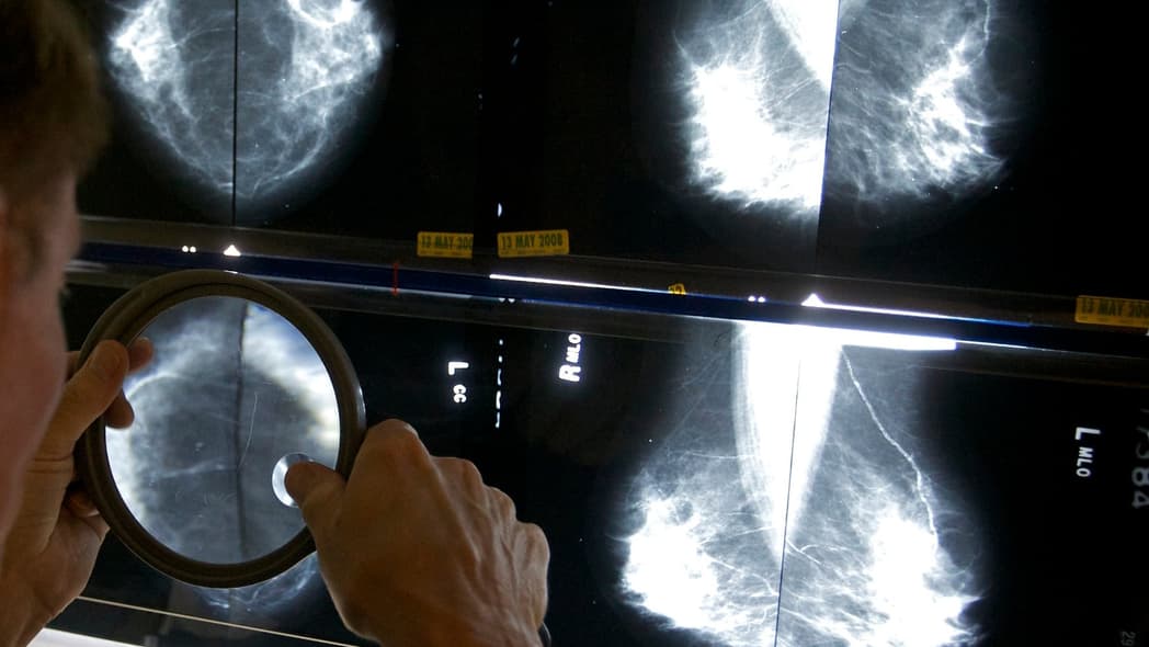 Breast cancer, theGrio.com