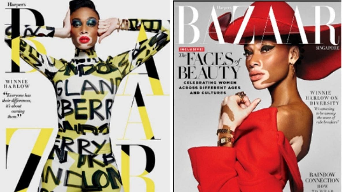 Winnie Harlow on Harper's Bazaar Singapore thegrio.com