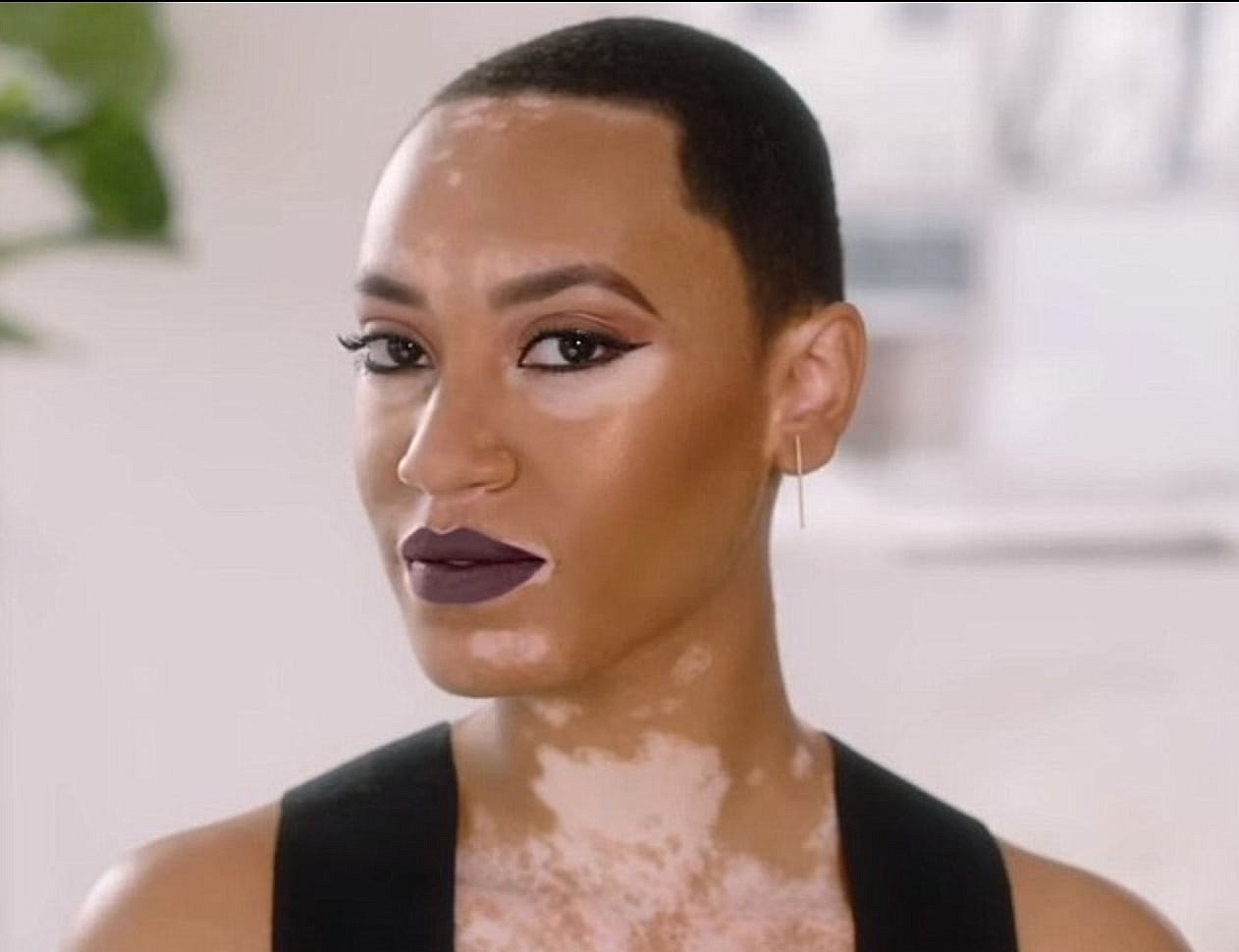 Amy Deanna becomes CoverGirl's first model with vitiligo. (CoverGirl) thegrio.com