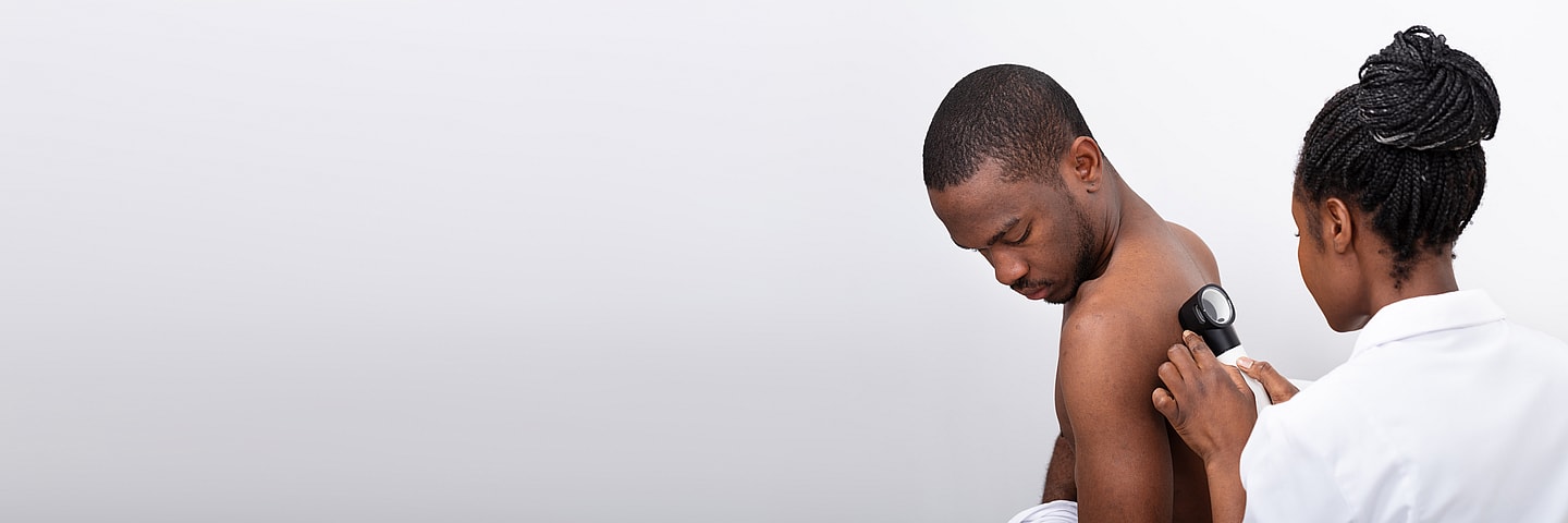 Melanoma in Black men