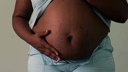 Childbirth