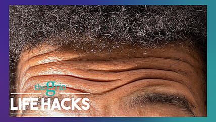 The process behind hairline lowering surgery | Life Hacks