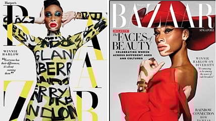 Winnie Harlow on Harper's Bazaar Singapore thegrio.com