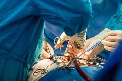 Black kidney transplant