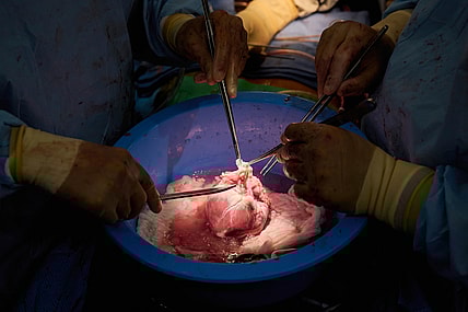 Surgeons prepare a genetically modified pig heart for transplant