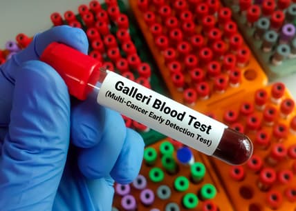 Galleri test