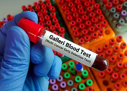 Galleri test