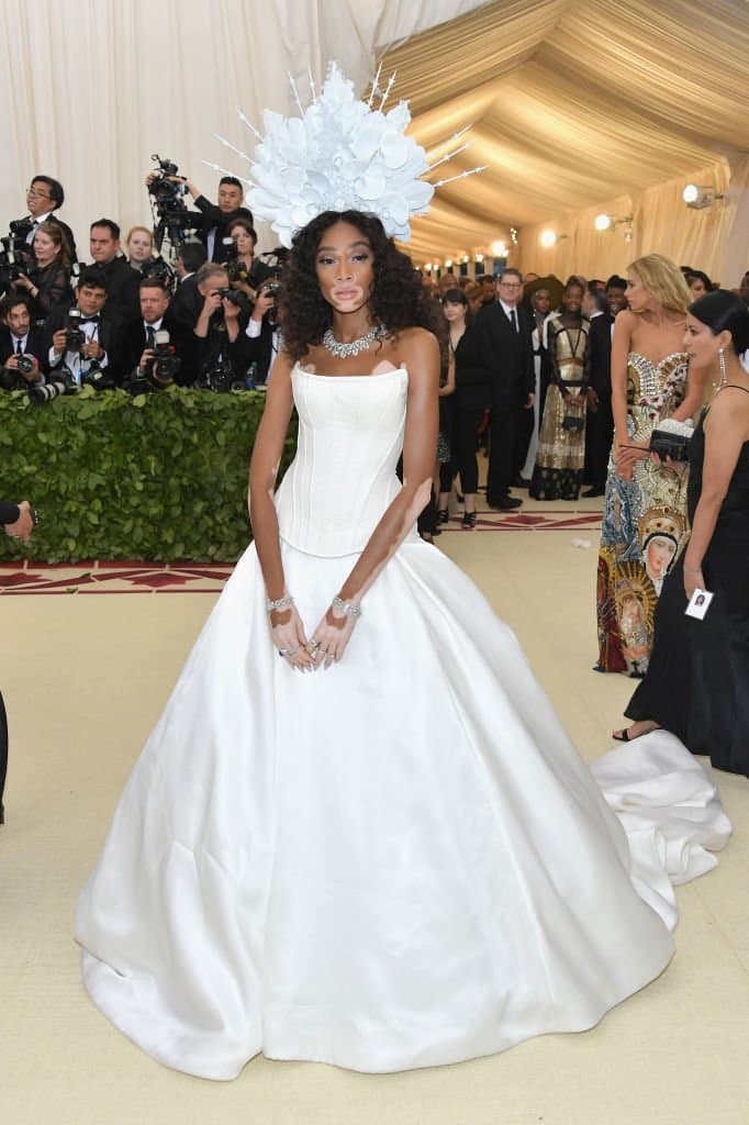 Winnie Harlow thegrio.com