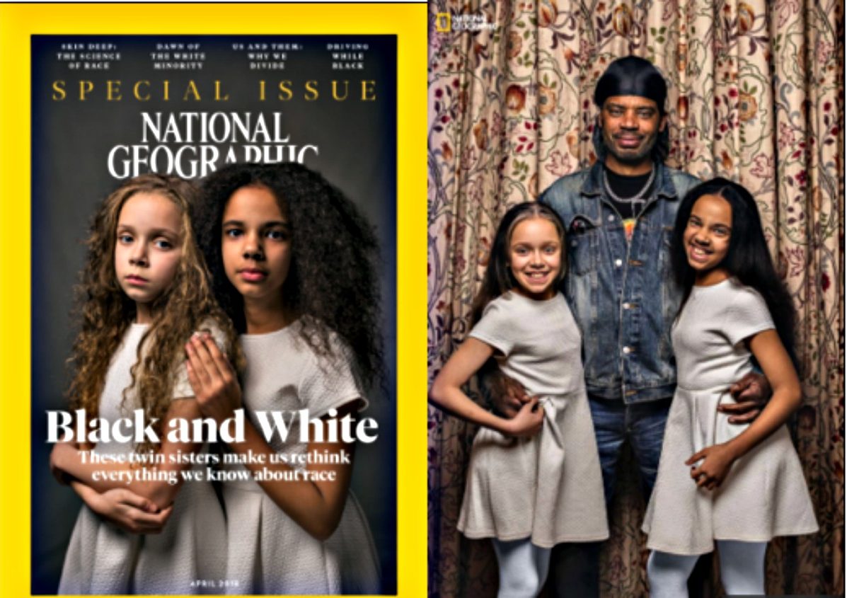 Twins Stump National Geographic Because Theyve Never Been To Black