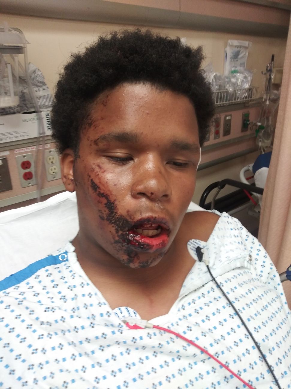 Bronx boy, 16, says NYPD brutalized him, made him walk 