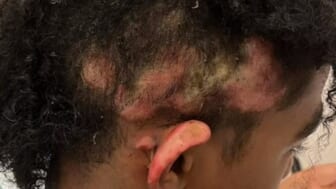 Middle school student charged after allegedly lighting classmate’s hair on fire