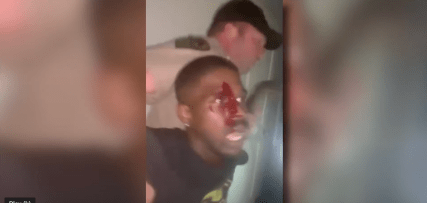 Video shows cops beating, stepping on head of Brandon Calloway after alleged stop sign violation 