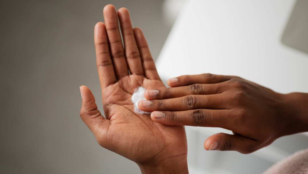 A hand rubbing in lotion on another hand