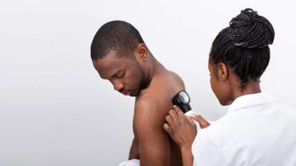Report: Melanoma more deadly in Black men, who may get it in unexpected places