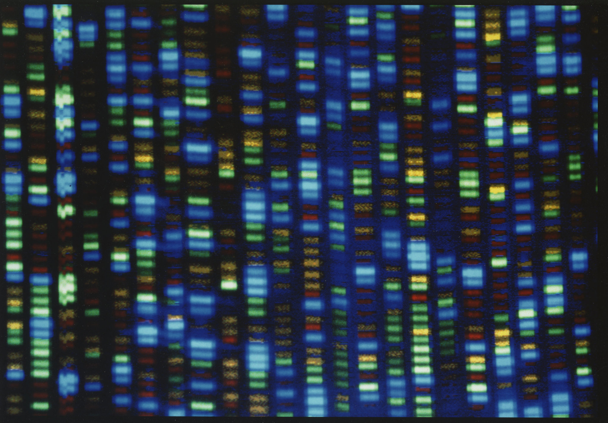 People of African ancestry are poorly represented in genetic studies. A new effort would change that
