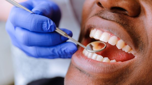 Free dental clinic aims to improve dental care of Black men