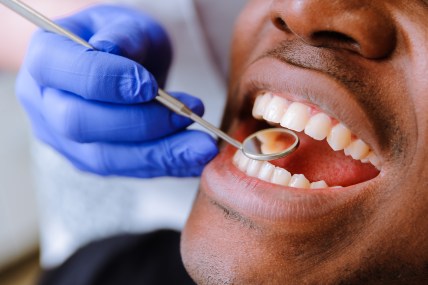 Free dental care Black men