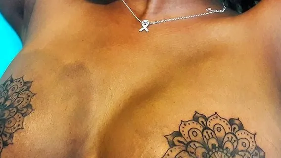 Woman Gets 'It's Called Vitiligo' Tattoo to Explain Skin Condition | Allure