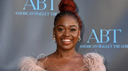 Michaela DePrince, Michaela DePrince death, Michaela DePrince ballerina, What skin condition did Michaela DePrince have?, michaela mabinty deprince, michaela mabinty deprince death, when did michaela deprince die? theGrio.com